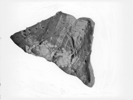 Scientific photograph of diseased ox liver.
