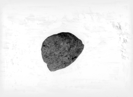 Pathological specimen.