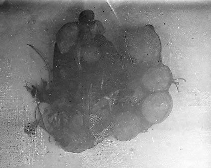Cover pathological photographs of Hydatid Cysts